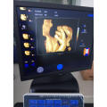 Ecocardiograma 2D 3D 4D Ecografo Ultrasound